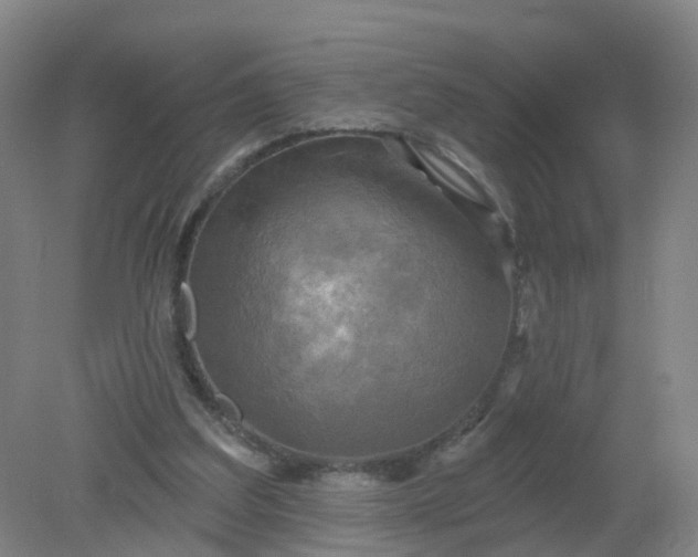 X0000079330203200612011916