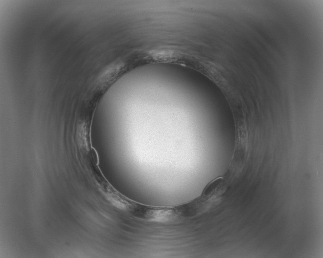 X0000079330575200612011911