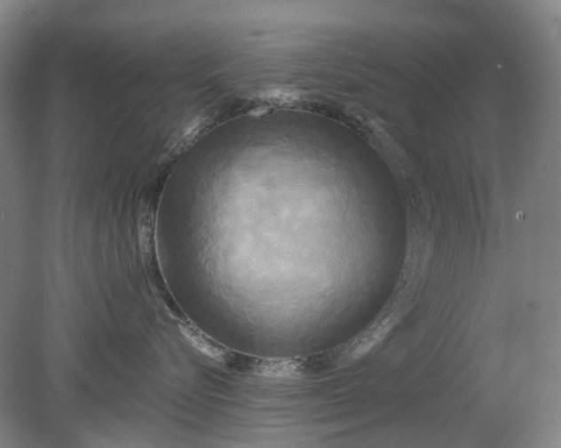 X0000079330576200612011911