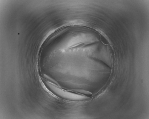 X0000079330941200612011904
