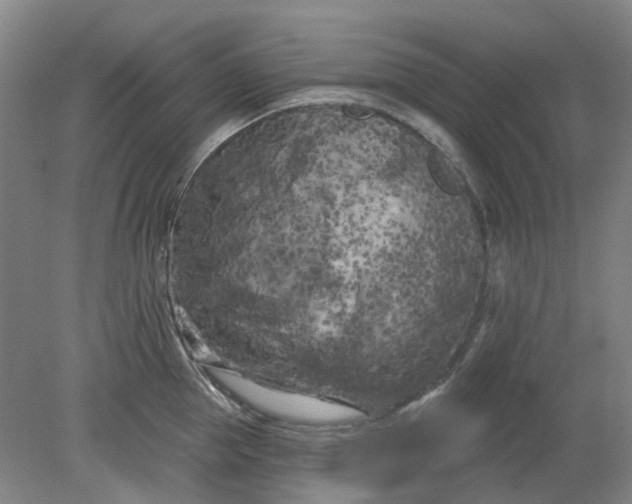 X0000079330953200612011904