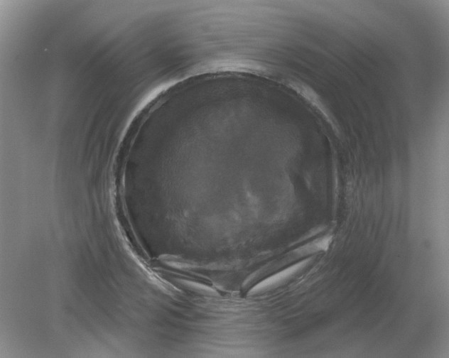 X0000079331024200612011902