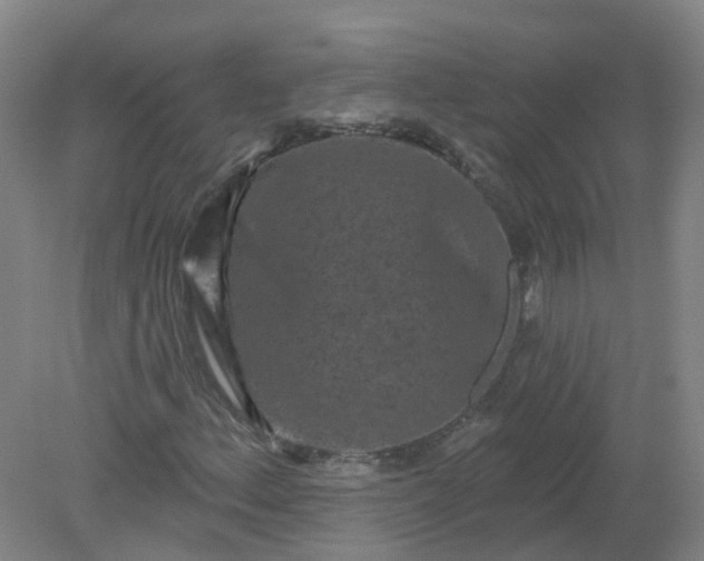 X0000079331156200612011900
