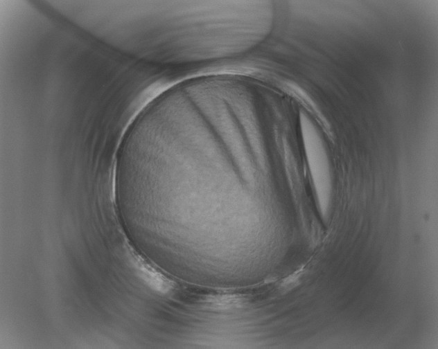 X0000079331276200612011858
