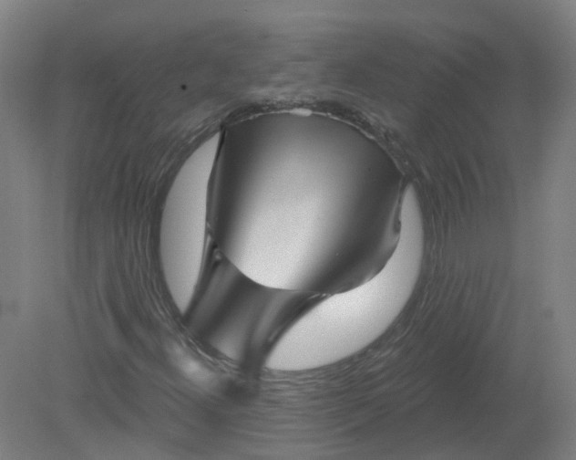 X0000079331300200612011857