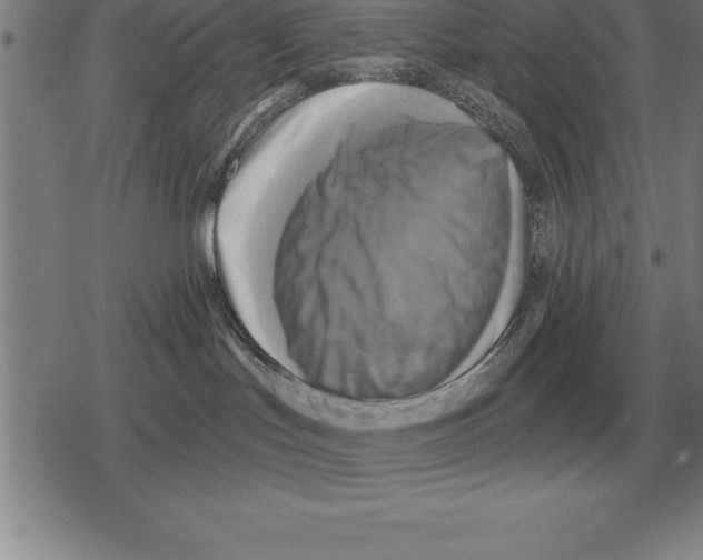 X0000079330047200612151853