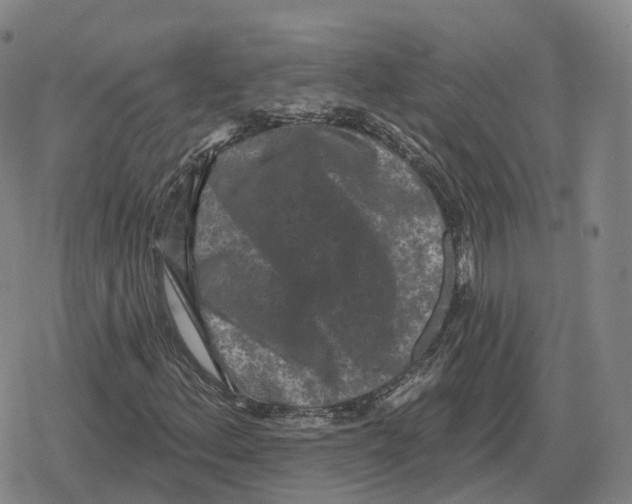 X0000079331156200612151835
