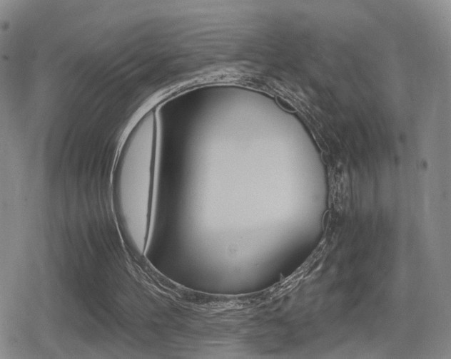 X0000079340100200611170941