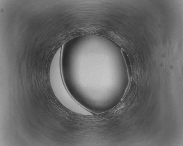 X0000079341010200611170926