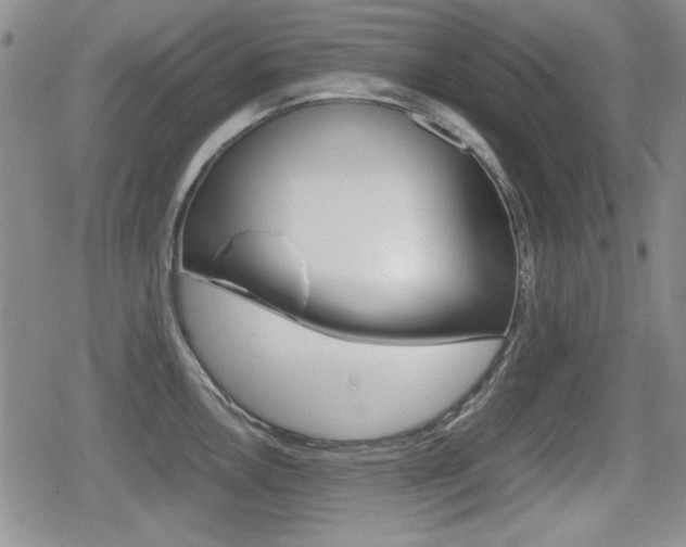 X0000079341146200611170925