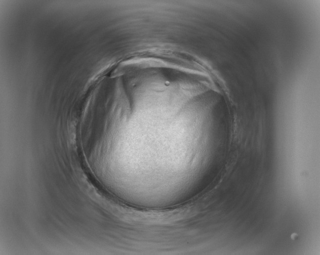 X0000079340010200612011946