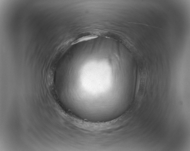 X0000079340043200612011945