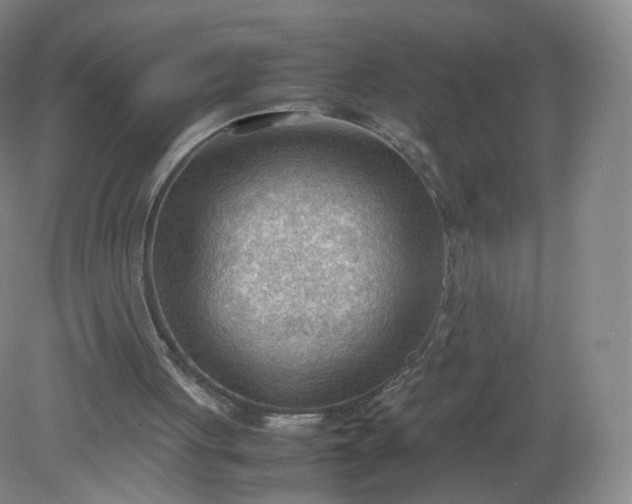 X0000079340051200612011944