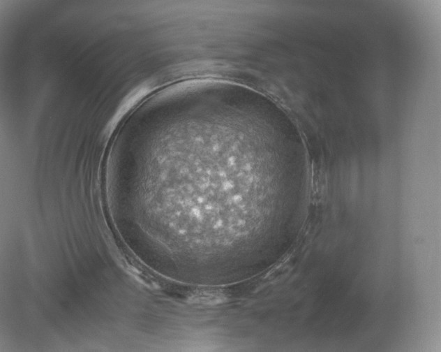 X0000079340099200612011944