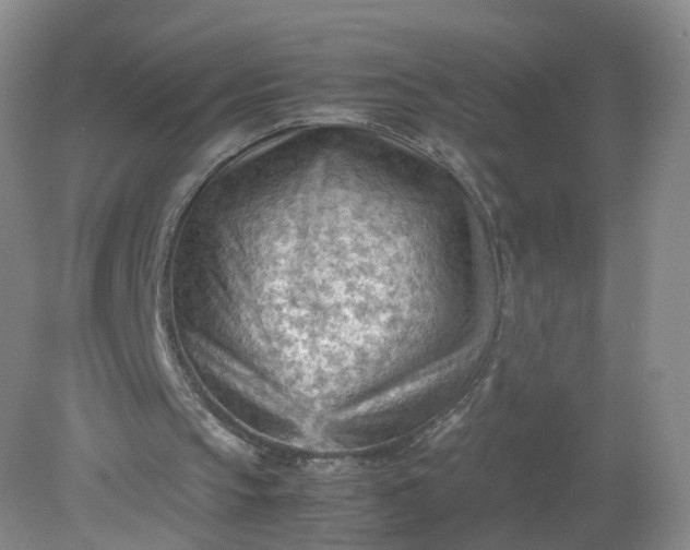 X0000079340145200612011942