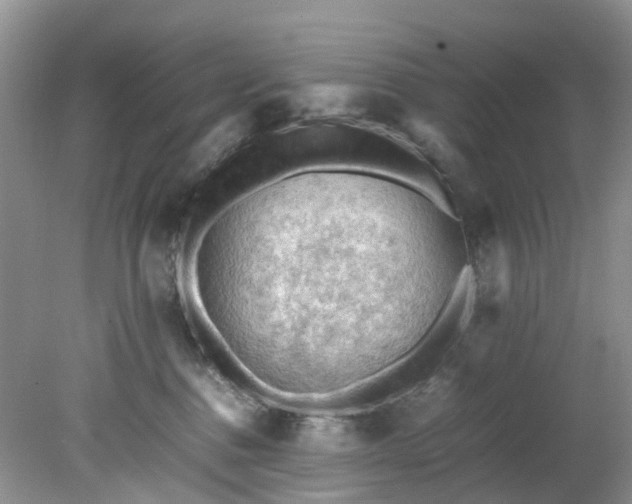 X0000079340376200612011940