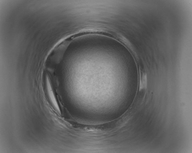 X0000079340387200612011939