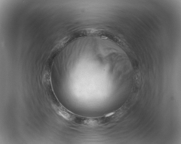 X0000079340419200612011939