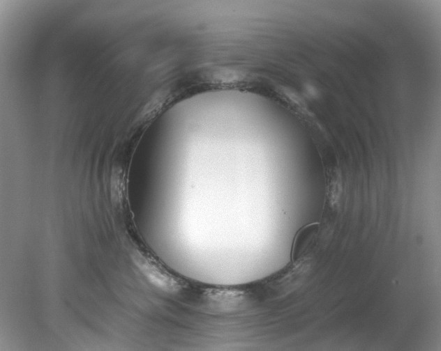 X0000079340476200612011938