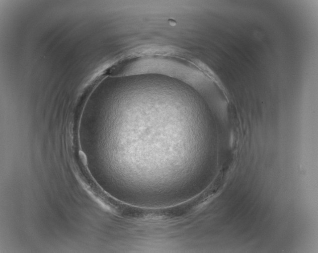 X0000079340581200612011936