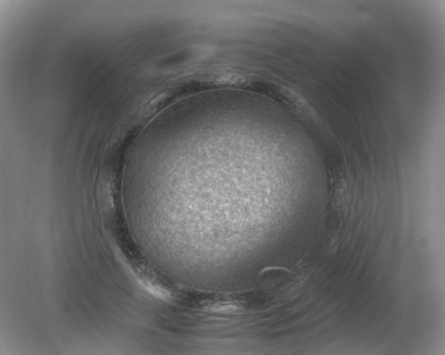 X0000079340643200612011935