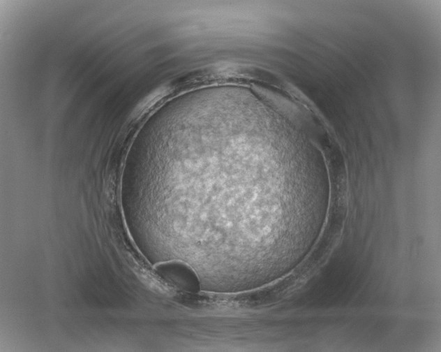 X0000079340785200612011933