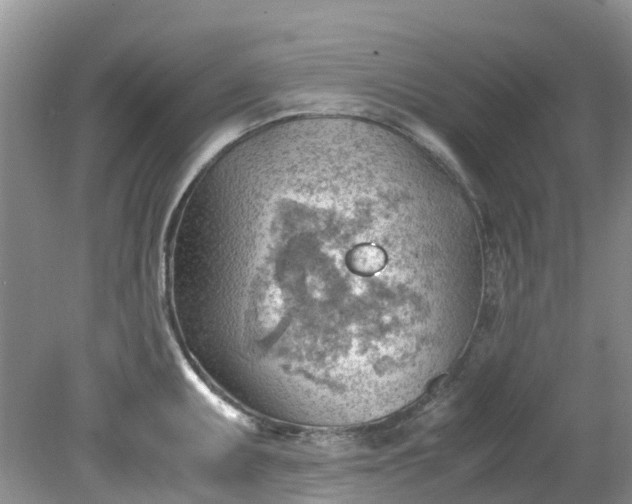 X0000079341095200612011927