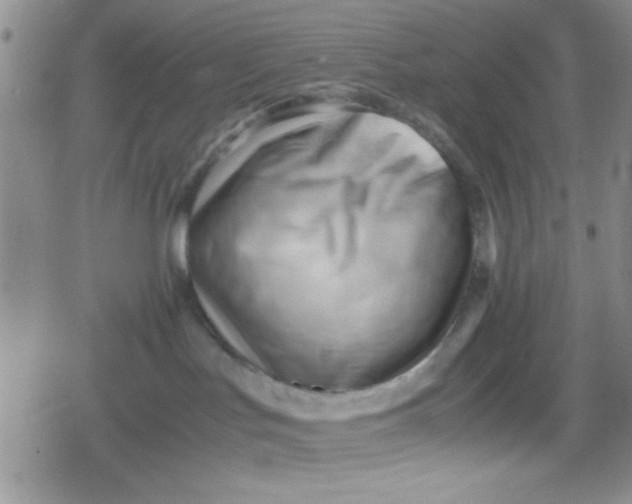 X0000079340047200612082035