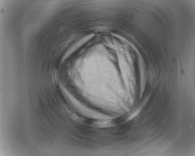 X0000079340093200612082035