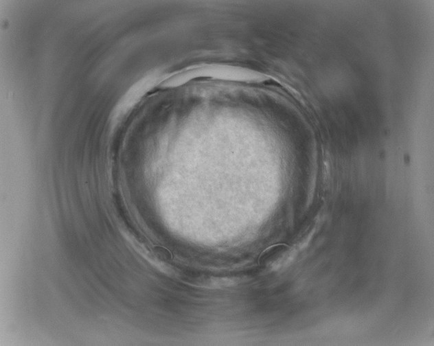 X0000079340149200612082033