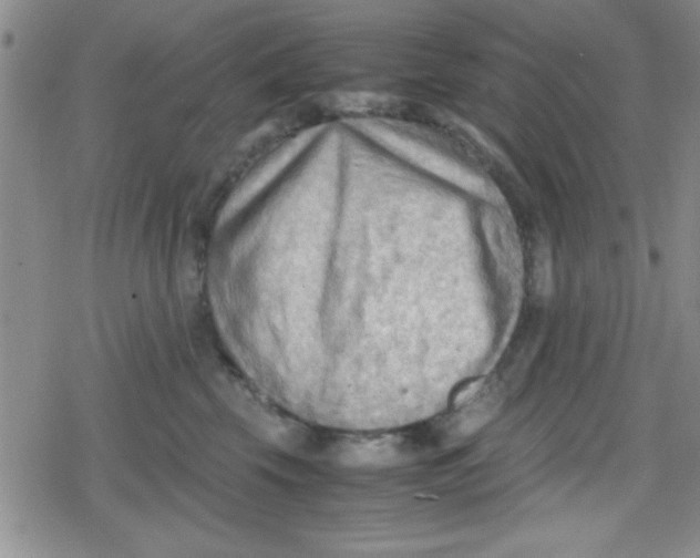 X0000079340569200612082027