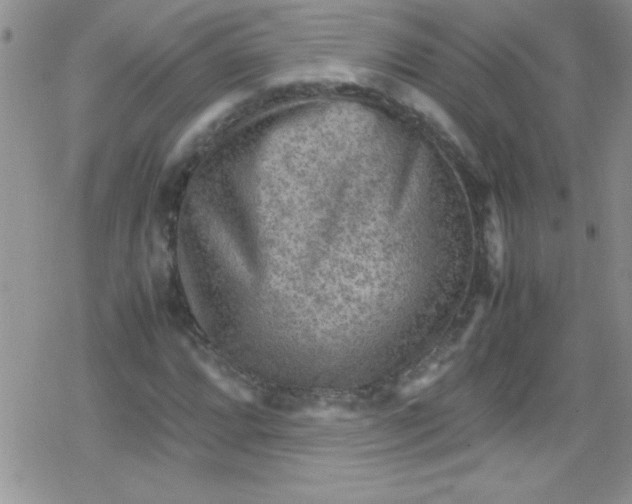 X0000079341064200612082018