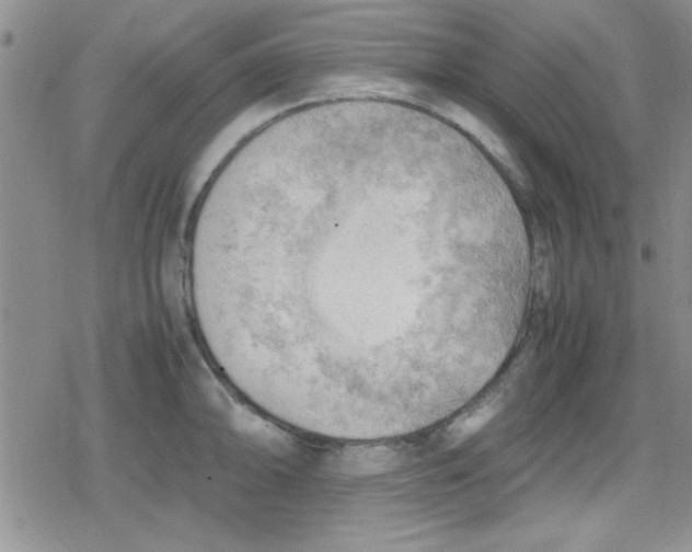 X0000079341094200612082018