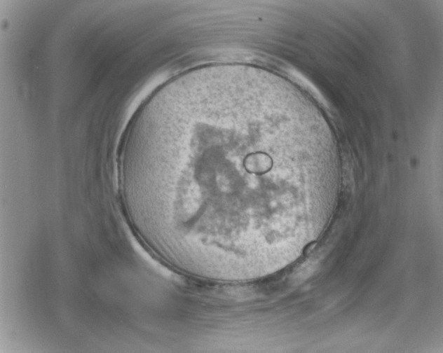 X0000079341095200612082018