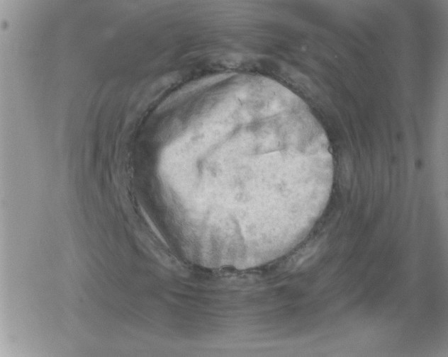 X0000079341105200612082017