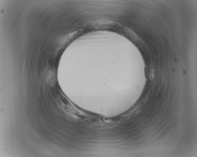 X0000079341108200612082017