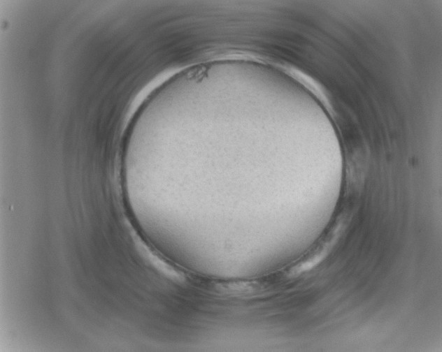 X0000079341149200612082018