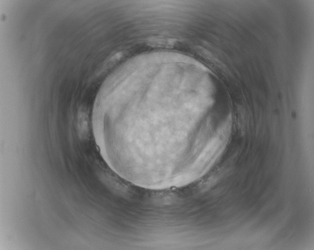 X0000079341154200612082017