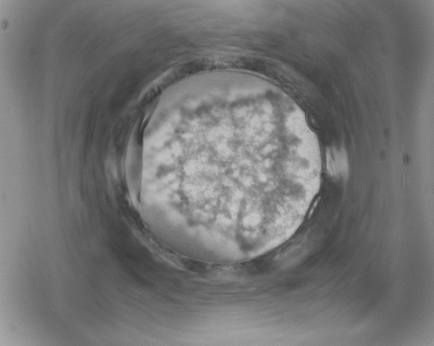 X0000079341155200612082017