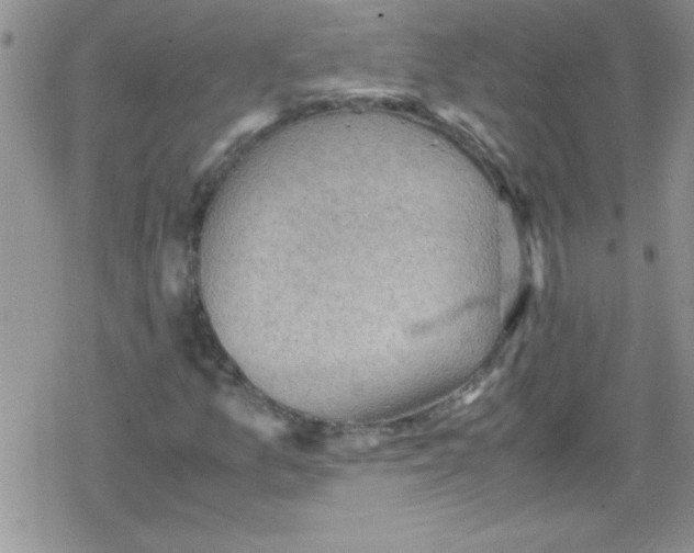 X0000079341157200612082017