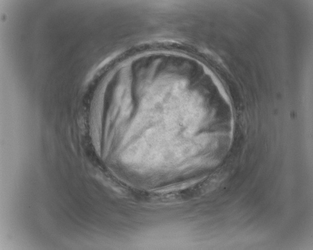 X0000079341159200612082017