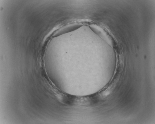 X0000079341165200612082017