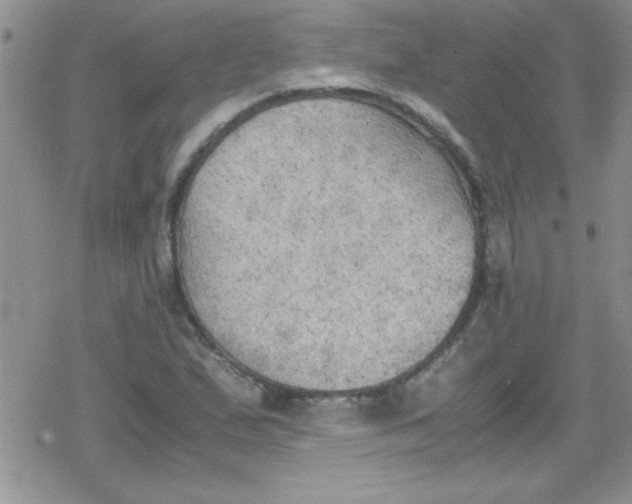 X0000079341167200612082017