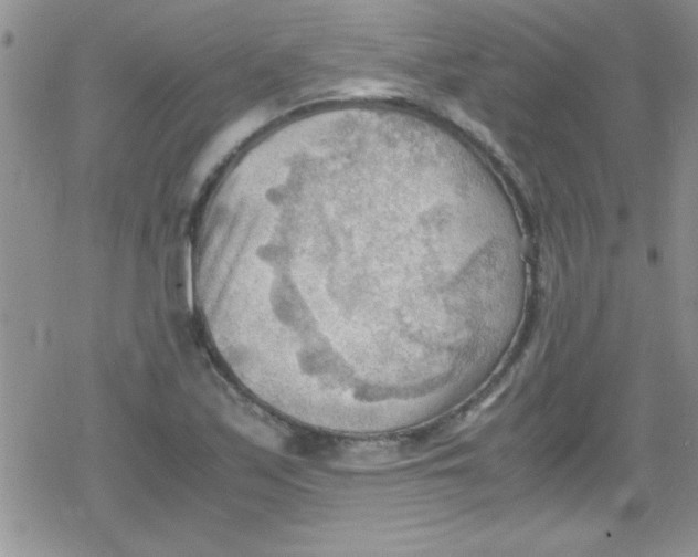 X0000079341171200612082017