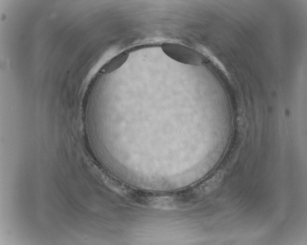 X0000079341173200612082017