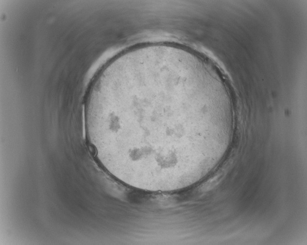 X0000079341175200612082017