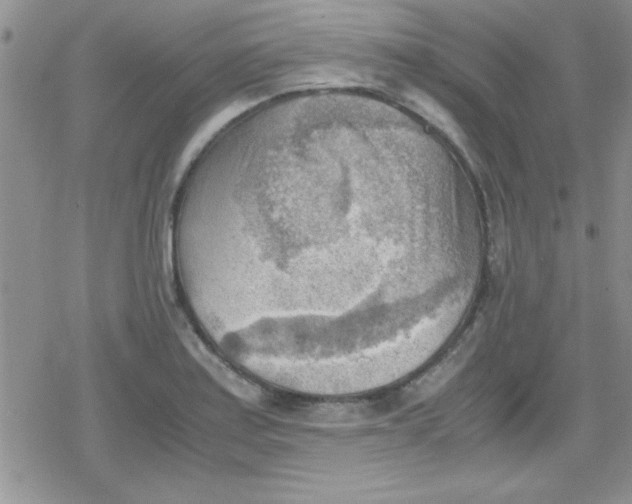 X0000079341179200612082017