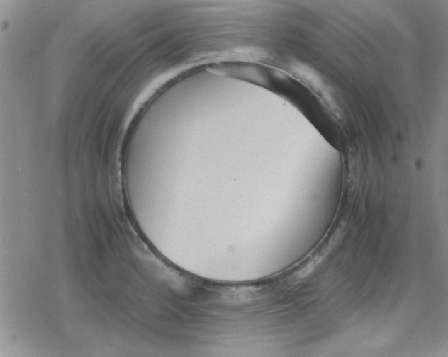 X0000079341184200612082017