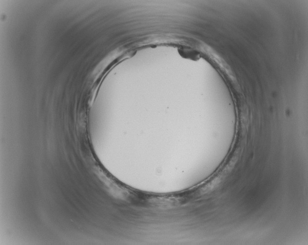 X0000079341185200612082017