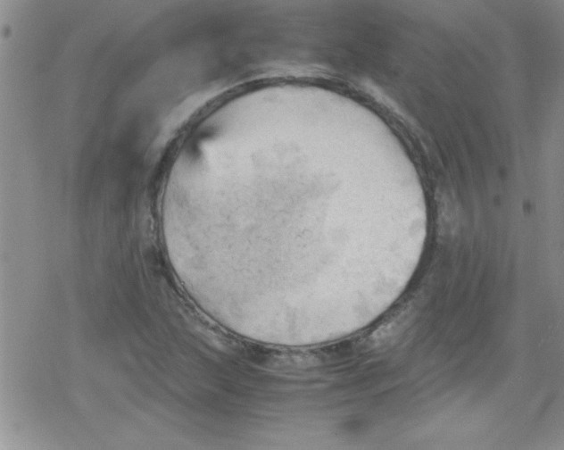 X0000079341215200612082016